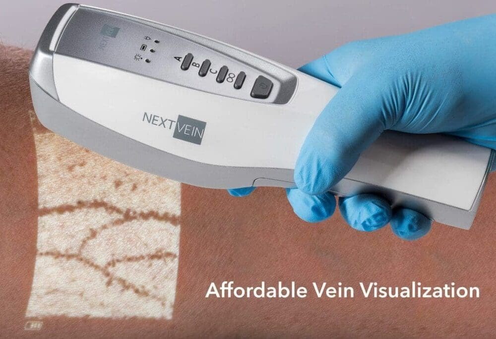NextVein Vein Finder In Use
