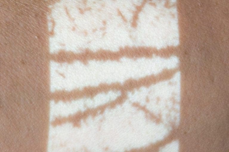 NextVein V800NV Augmented Reality Vein Projection – Dark Veins, White Background