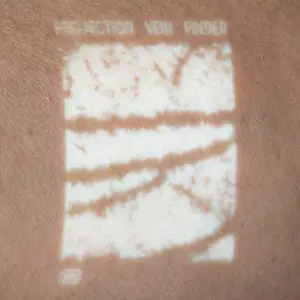 NextVein V800NV Augmented Reality Vein Projection – Dark Veins, White Background