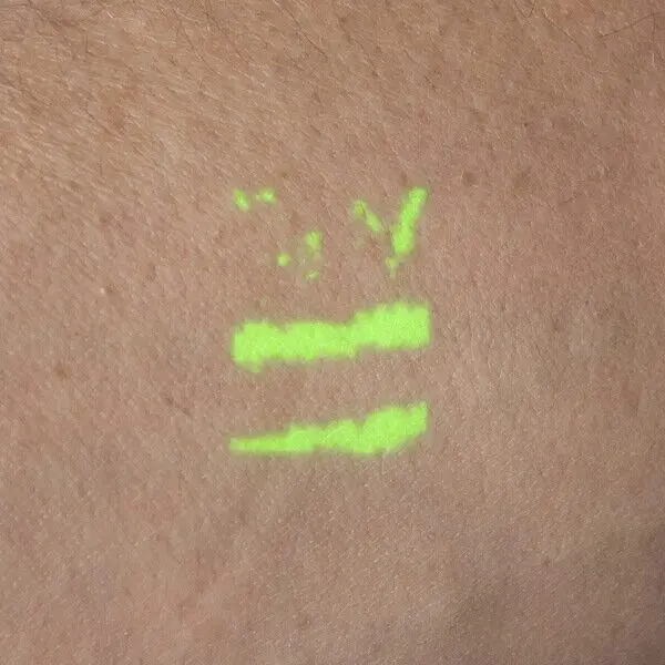 A closeup of the NextVein vein finder projection showing a small size projection with green veins on a dark background.