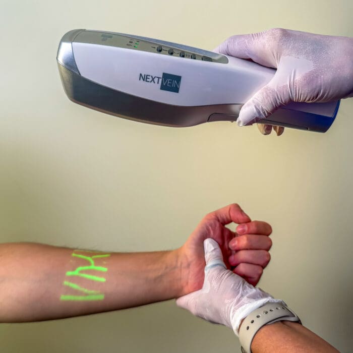 arm