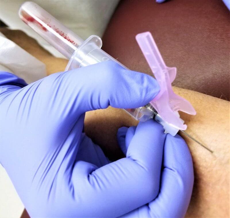 A phlebotomist drawing blood from a patient.