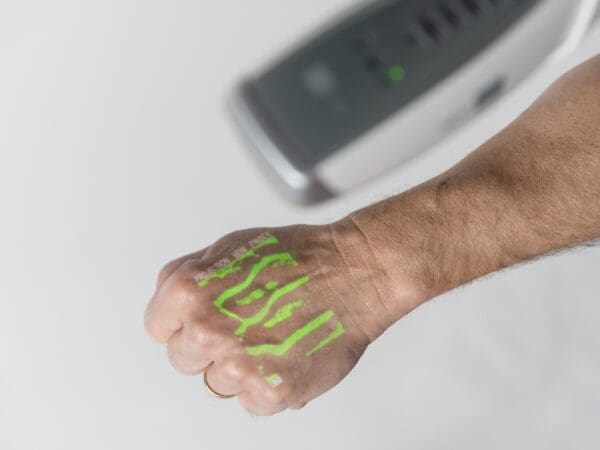 NextVein V800NV Vein Finder Device Showing Augmented Reality Vein Pattern In Green Color Projection