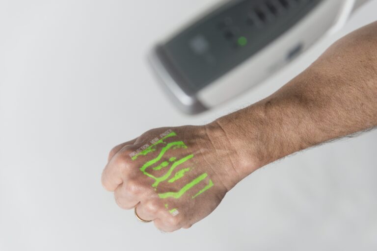 NextVein V800NV Vein Finder Device Showing Augmented Reality Vein Pattern In Green Color Projection