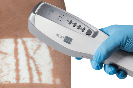 The NextVein vein finder is shown being held in a gloved hand over a white vein projection.