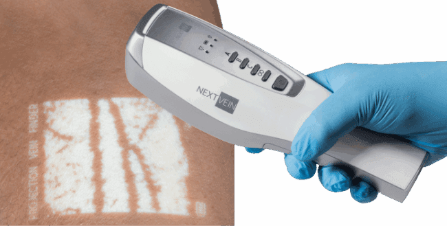 The NextVein vein finder is shown being held in a gloved hand over a white vein projection.