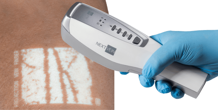 The NextVein vein finder is shown being held in a gloved hand over a white vein projection.